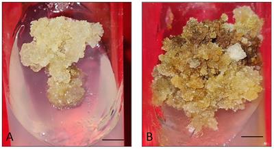 Integrated GC-MS and UPLC-ESI-QTOF-MS based untargeted metabolomics analysis of in vitro raised tissues of Digitalis purpurea L